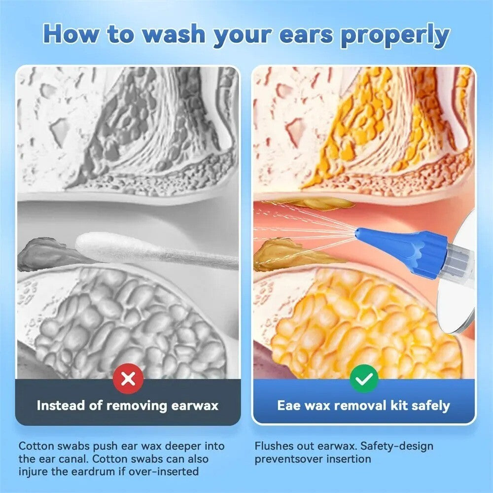 Ear Wax Removal Manual Ear Cleaner Water Cleaner Earwax Remover Kit