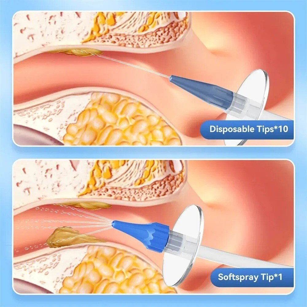 Ear Wax Removal Manual Ear Cleaner Water Cleaner Earwax Remover Kit