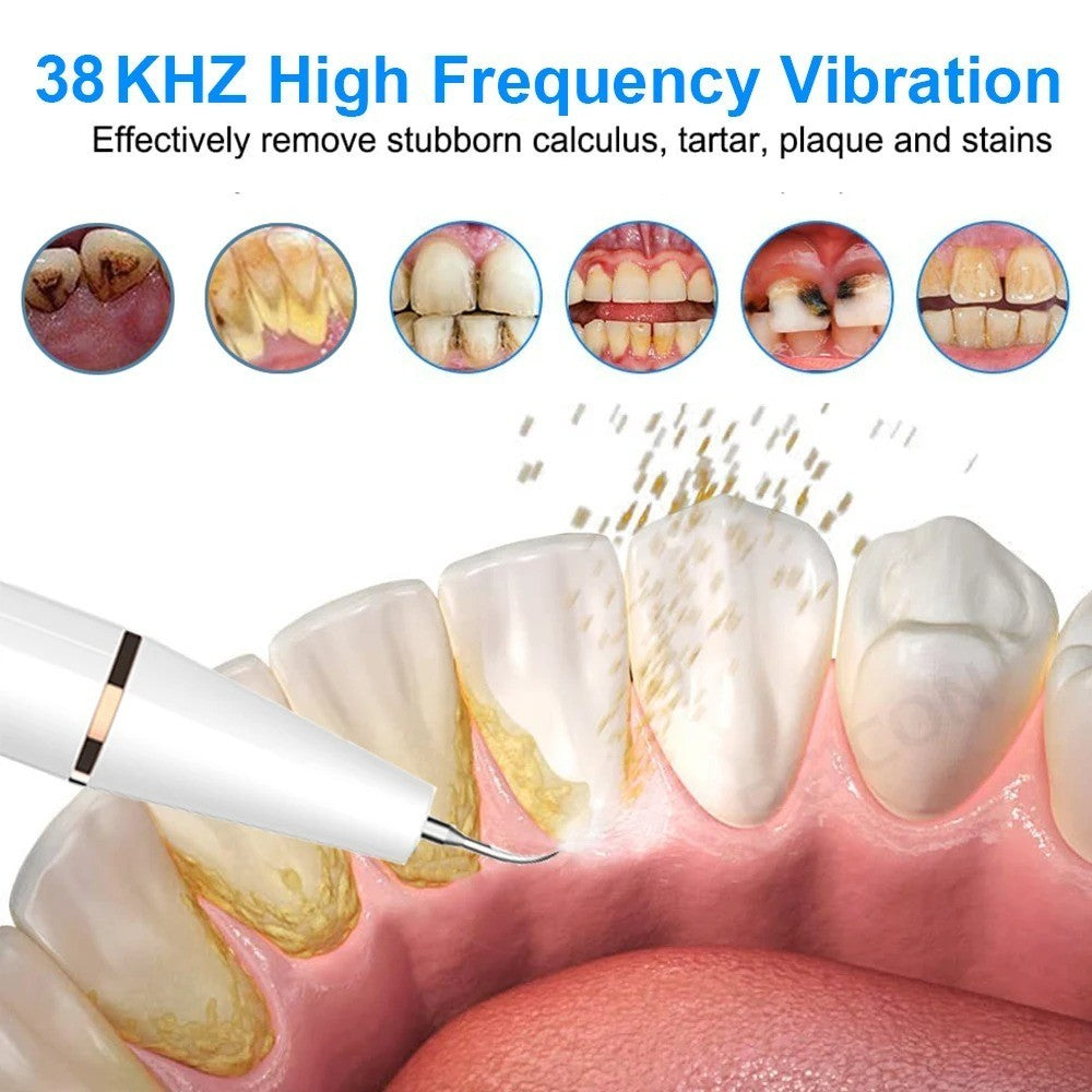 Ultrasonic Dental Tartar Cleaner Dental Scaling Ultrasound Tartar Eliminator